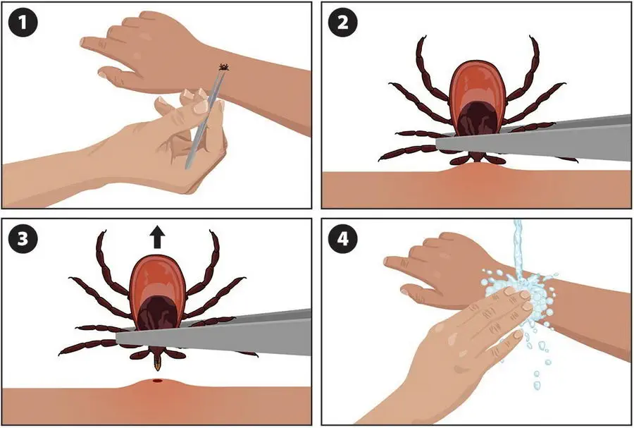 Ochrona przed kleszczami.